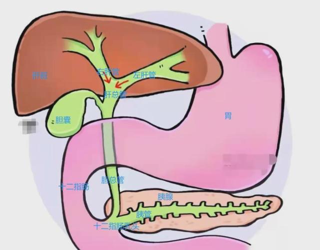 胆总管,胆总管与胰管相遇,一起进入十二指肠肠壁并汇合形成肝胰壶腹
