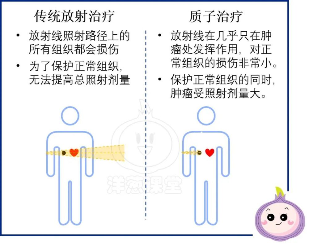 肿瘤放射治疗中的利刃质子治疗