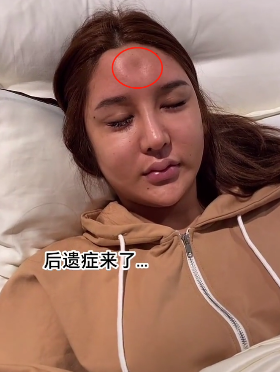 女网红晒整容失败视频,眼睛睁不开,嘴肿成"嘟嘟唇"