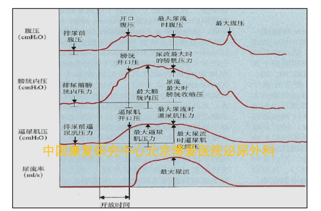 尿流延迟:从膀胱压发生改变到尿流率发生改变的延迟时间.