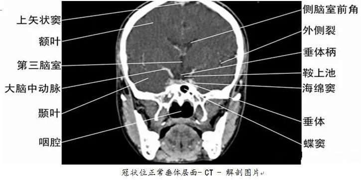 【医科普】全身ct图谱,速收藏!