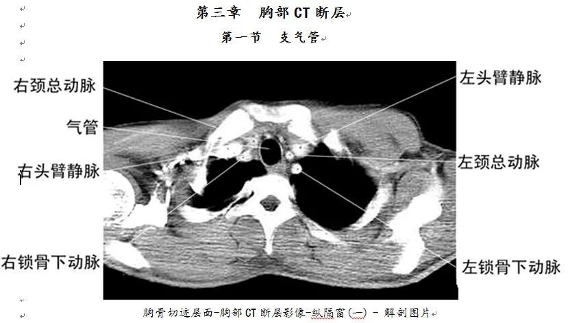 【医科普】全身ct图谱,速收藏!