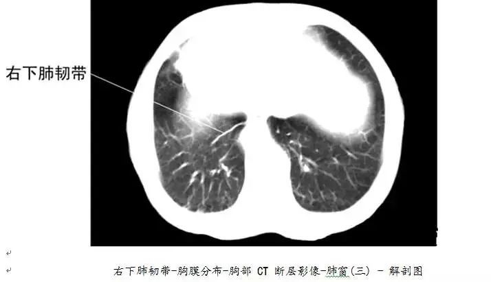 【医科普】全身ct图谱,速收藏!