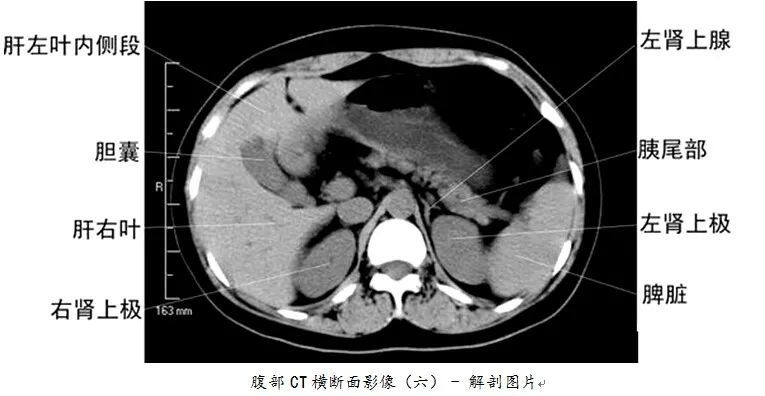 医科普全身ct图谱速收藏