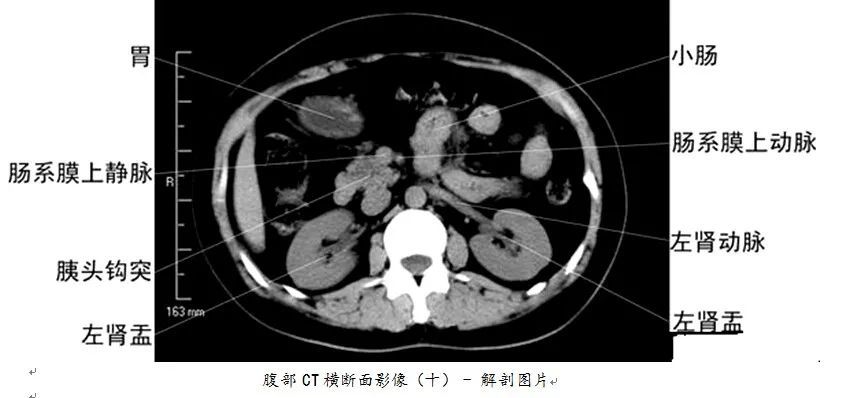 【医科普】全身ct图谱,速收藏!