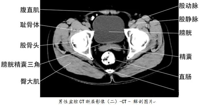 【医科普】全身ct图谱,速收藏!