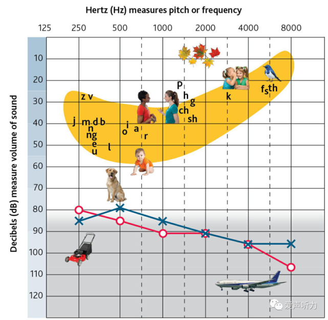 听力曲线及言语香蕉图