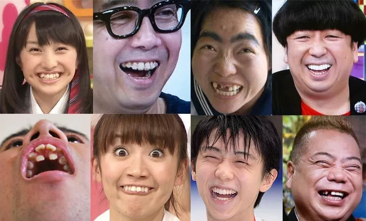 为什么日本人的牙齿普遍都很丑陋