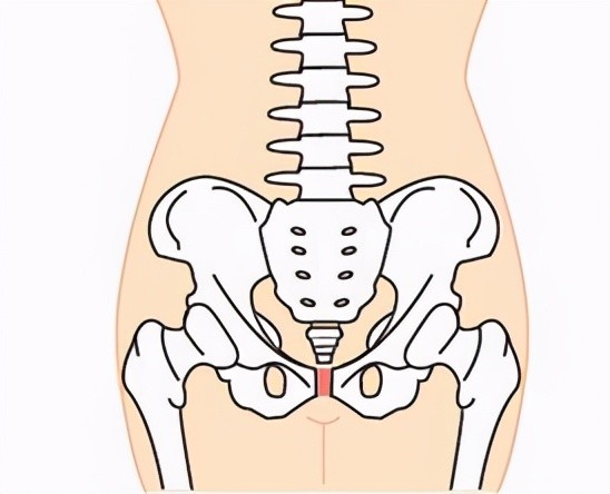 20多岁女性下腹部反复不适,原是盆底出了问题!女同胞注意