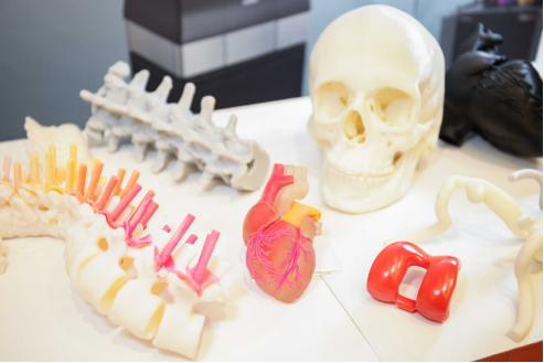 盘点|国内的3d打印医疗临床应用案例,众望所归!