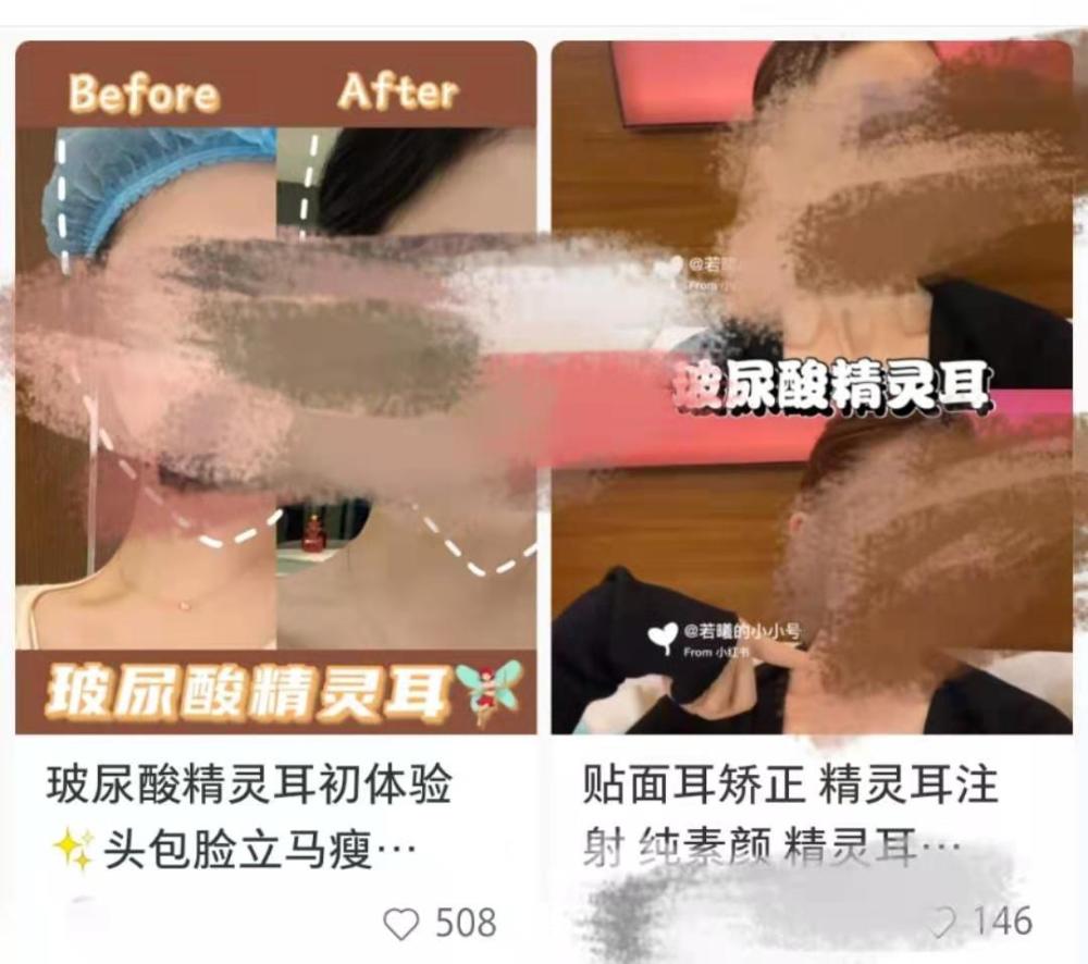 网红鼓吹"精灵耳"等自残式整容,容貌内卷何以至此