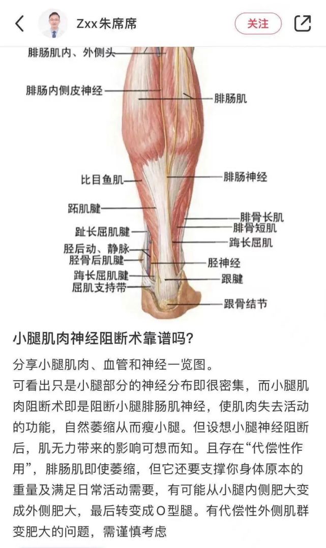 为了瘦成漫画腿,她切断了小腿神经