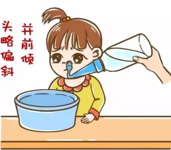 鼻塞≠感冒!排除这3种情况才能在家进行简单护理