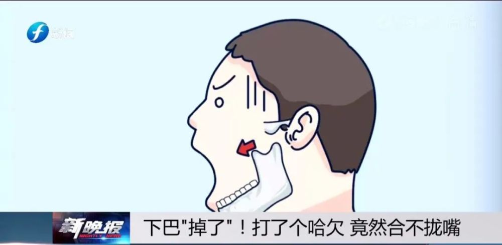 打了个哈欠,下巴"掉了!