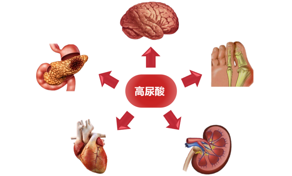 高尿酸血症痛风高尿酸血症怎么办