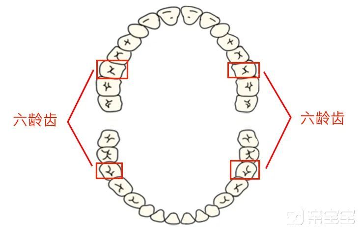 第一恒磨牙",很多人习惯叫它"六龄齿",是因为它一般在孩子 6 岁时萌出