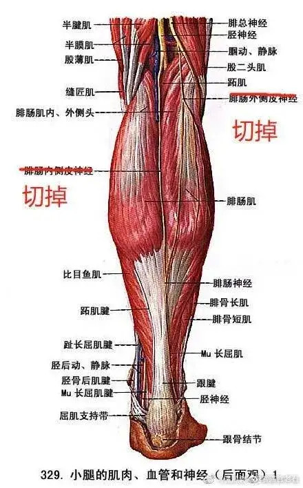 花35000元挑断脚筋:为了变美变瘦,这些女人被骗惨了