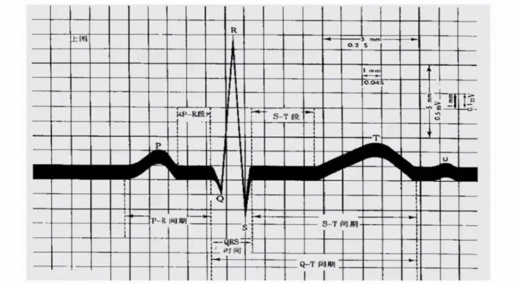 一看心电图就犯晕?超全心电专辑教你读心