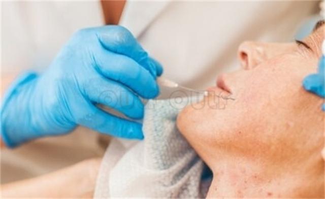 脸部变宽,面部线雕术多久消肿,由于线雕比传统的除 皱 手 术要轻创些