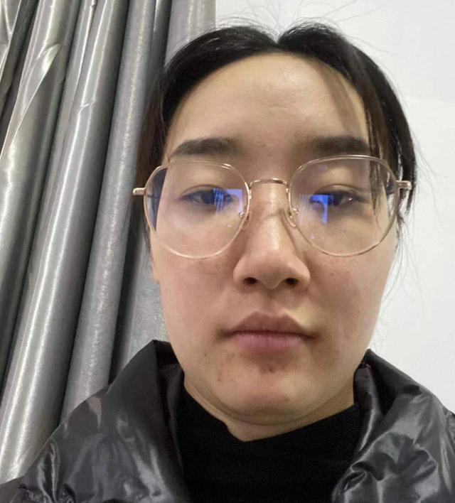 戴眼镜的女生很呆长期戴眼镜这4个特征很明显拉低颜值