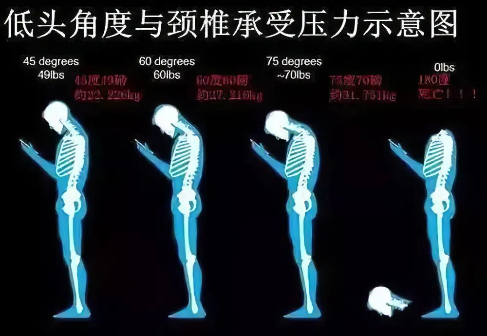 太极拳防治颈椎病有特效可惜太多人练错了