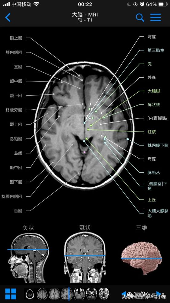 【高清mri图】颅脑磁共振mri解剖