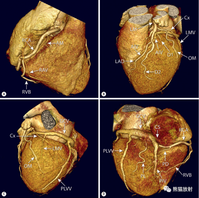 冠状动脉和心脏静脉