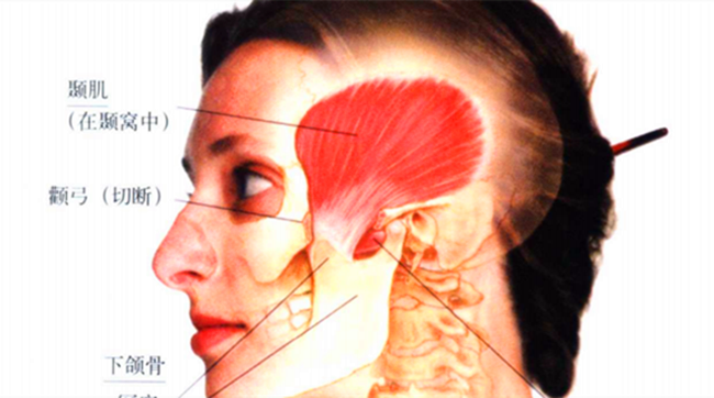 常有头侧面及下颌疼痛是怎么回事多与面部这块肌肉有关系