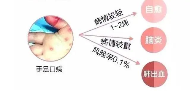 疱疹性咽峡炎科普知识——哈迪宝贝托育园保健室温馨出品