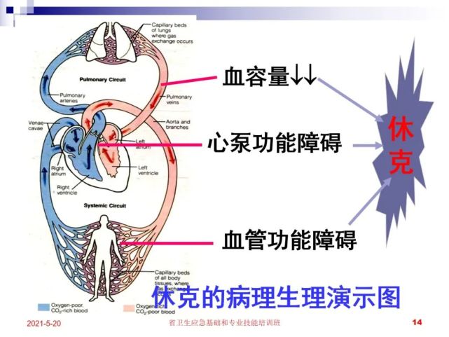 ppt创伤性休克的紧急救治,再详细不过了!