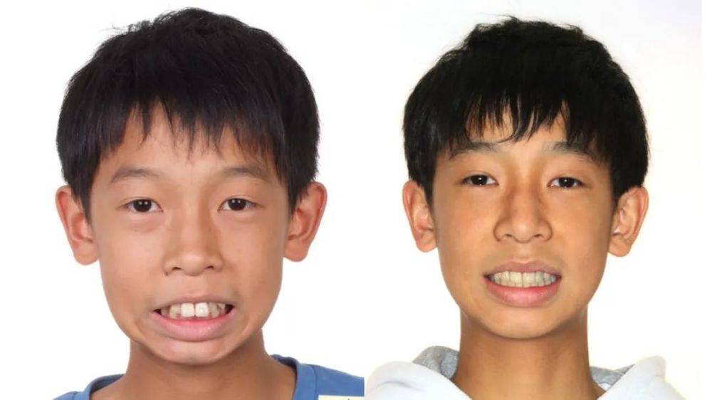 孩子睡觉若有这种表现,不仅会越长越丑,还有可能越来越笨!