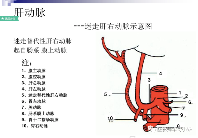 【高清血管图】全身动脉血管(彩色)