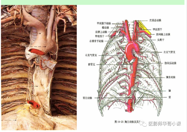 【高清血管图】全身动脉血管(彩色)