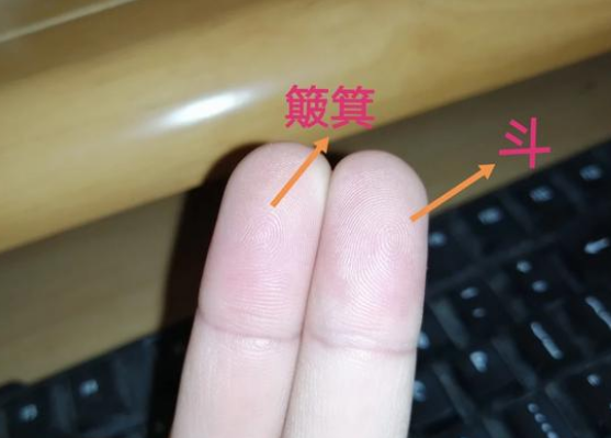 先生的指纹情况来举例,据说他的十根手指的指肚上的纹路都是簸箕