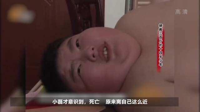 14岁男孩重300斤一晚吃18包方便面父母费尽力气拯救儿子生命