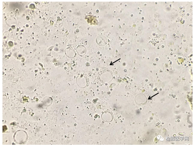 人芽囊原虫你了解多少?一文看遍所有形态美图