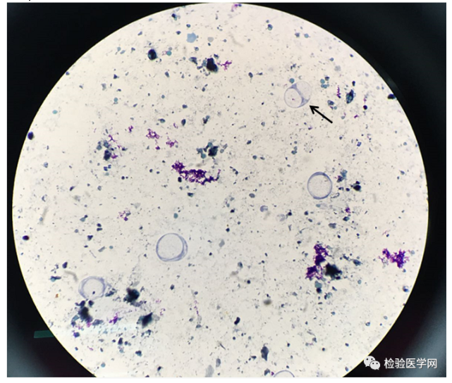 人芽囊原虫你了解多少?一文看遍所有形态美图