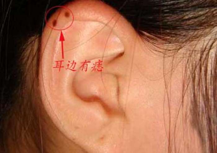 有这样几颗痣的女人,都是超级旺夫女,娶到就是赚到!