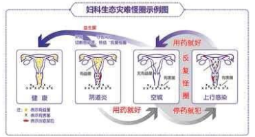 妇科炎症自查表|阴道炎|盆腔炎|妇科疾病|宫颈炎