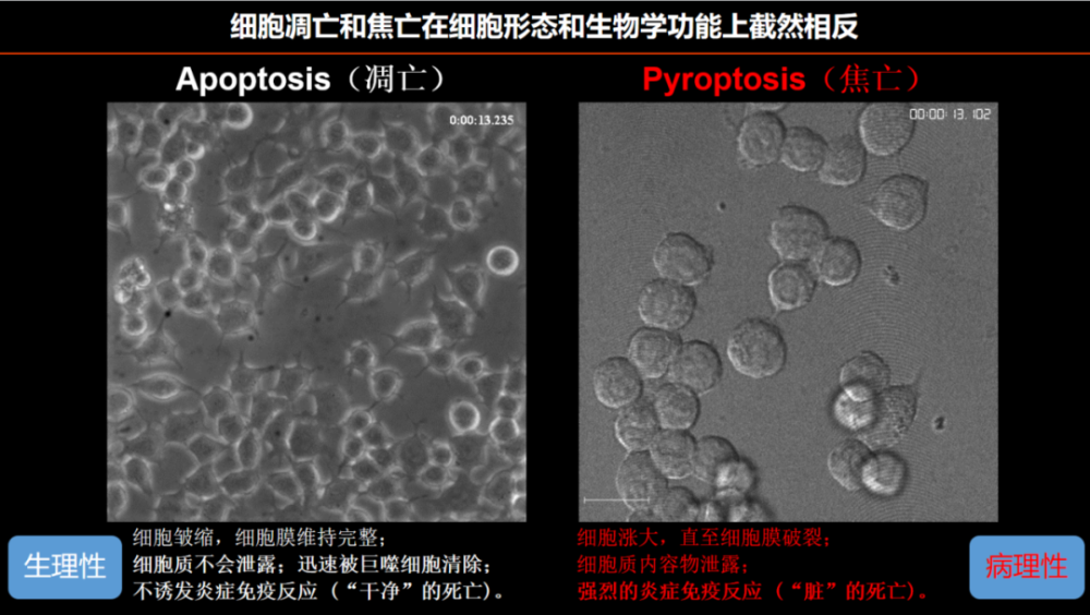 邵峰院士:细胞焦亡,炎症和肿瘤免疫