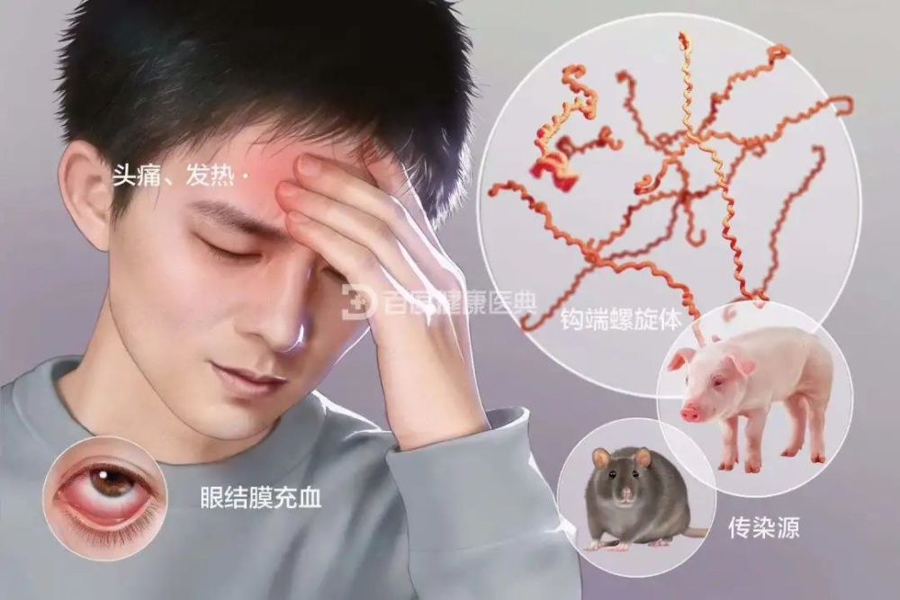如何有效预防钩端螺旋体感染呢?