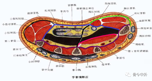 筋膜间隙:位于掌中间鞘深部,内有疏松结缔组织,包括外侧的鱼际间隙和
