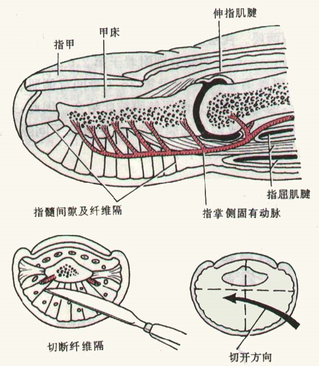 手指浅,深屈肌腱:指伸肌腱与指背腱膜:指腱鞘:拇指,指腹感染或甲沟炎