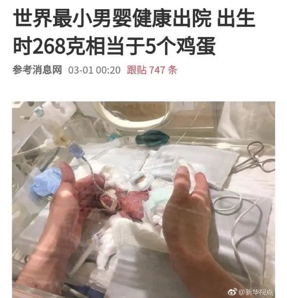 21周胎龄不到300克仅手掌大小过早来到人间生活太难了