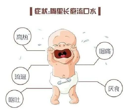 近期高发|科学认识和应对疱疹性咽峡炎