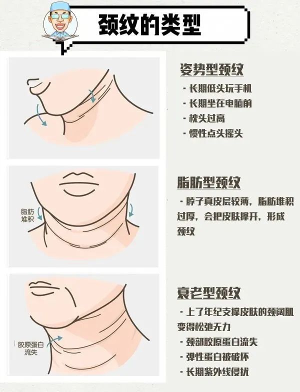 1,先天性颈部皮肤松弛或脂肪堆积.