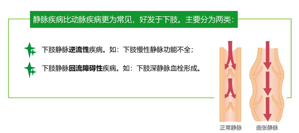 痔的形成主要是由静脉扩张,淤血所致直肠静脉属门脉系统,无静脉瓣