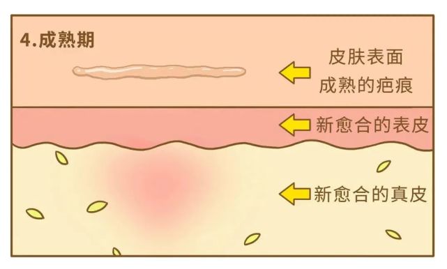 图片来源:giphy.com最后疤没去掉,皮肤反而被折腾得愈发敏感.