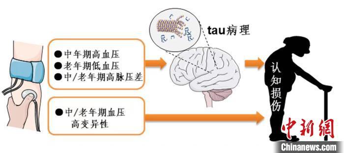 临床队列研究解密血压与认知损伤的关系. 研究示意图