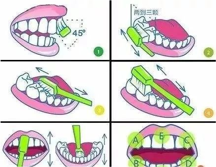 为什么你每天按时刷牙,还是会有蛀牙?